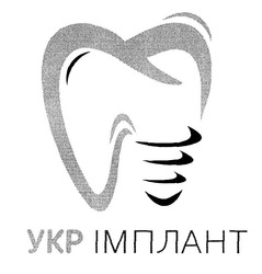 Свідоцтво торговельну марку № 302692 (заявка m201923214): укр імплант