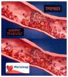 Свідоцтво торговельну марку № 284062 (заявка m201823708): магнікор; тромбоз; інфаркт та інсульт