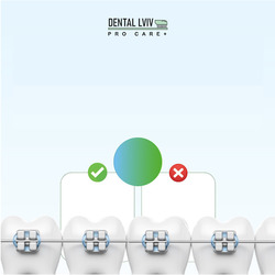 Заявка на торговельну марку № m202520685: х; x; pro care+; dental lviv